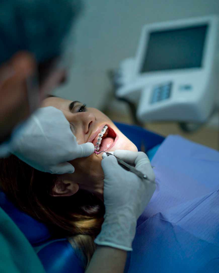 Dental Braces Treatment in Kolkata | Orofacial Polyclinic 