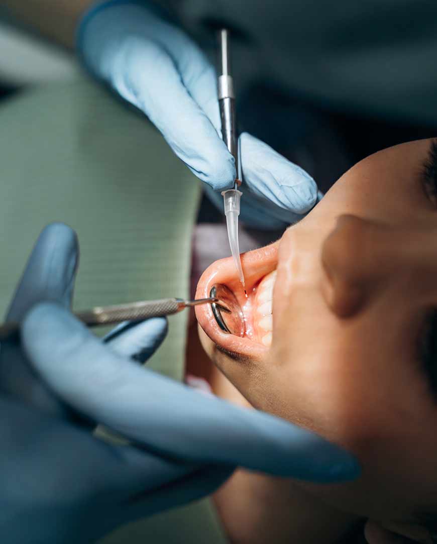 Cyst Removal Surgery in Kolkata | Orofacial Polyclinic 