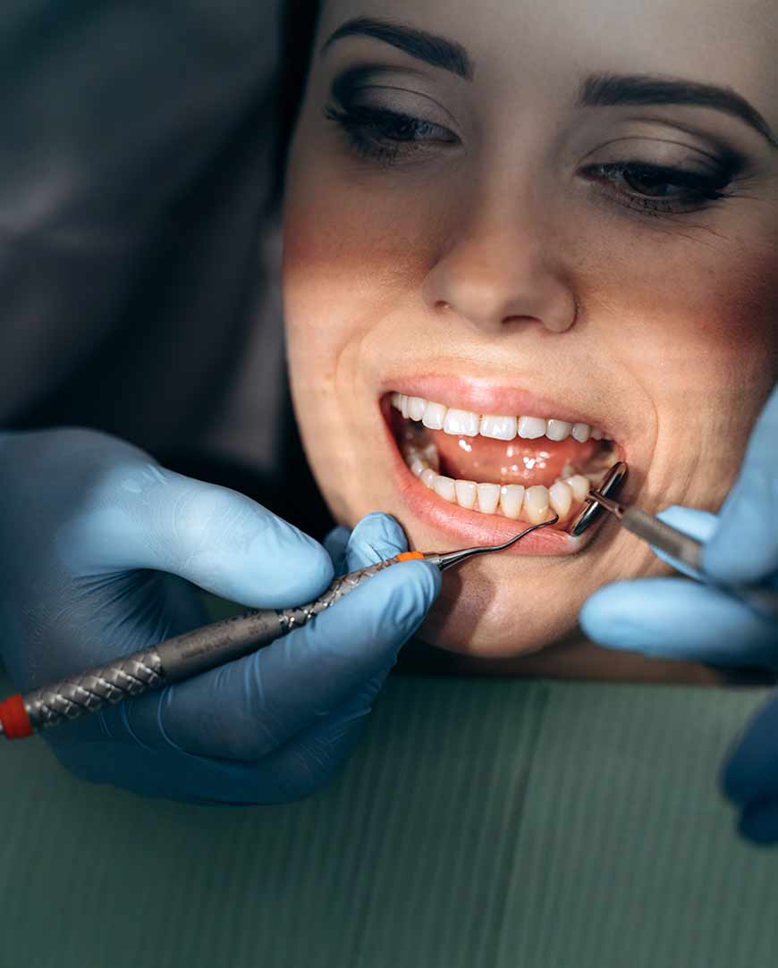 Dental Scaling/Polishing in Kolkata | Orofacial Polyclinic 