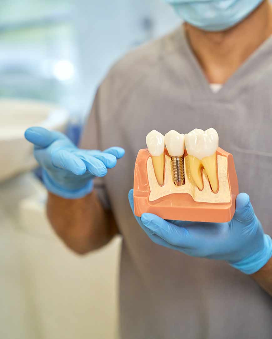 Dental Implants Clinic in Kolkata | Orofacial Polyclinic 